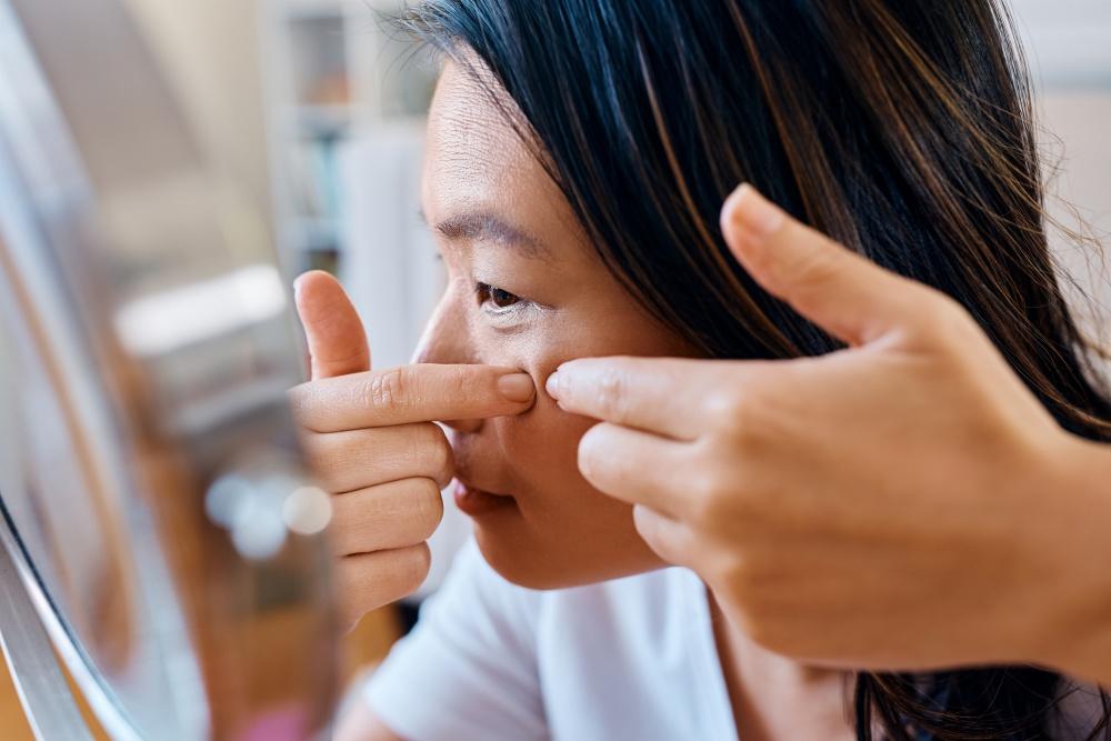 A Study in Pore Clarity: Sebaceous Filaments vs Blackheads