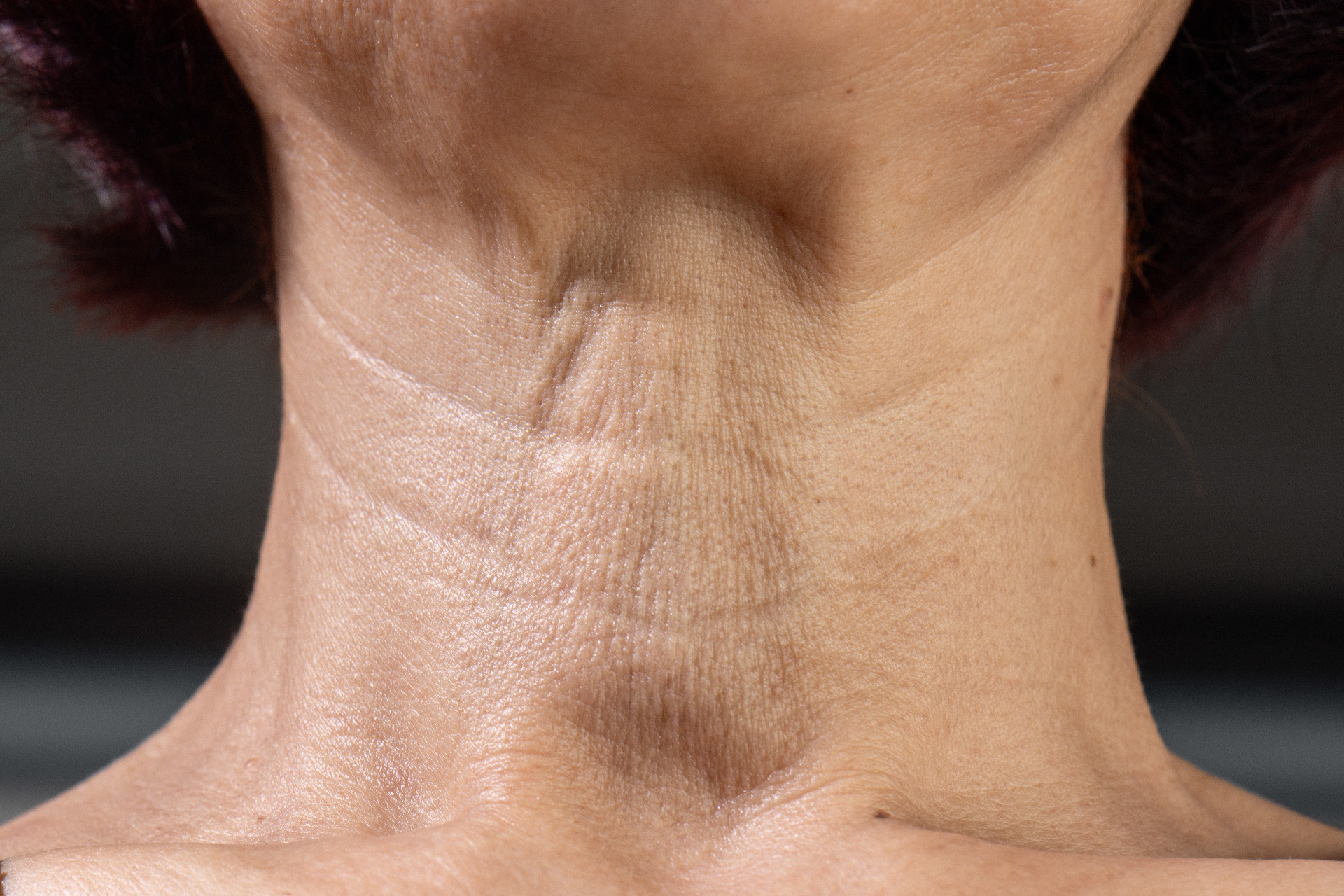8 Types of Anti Aging Treatments to Know