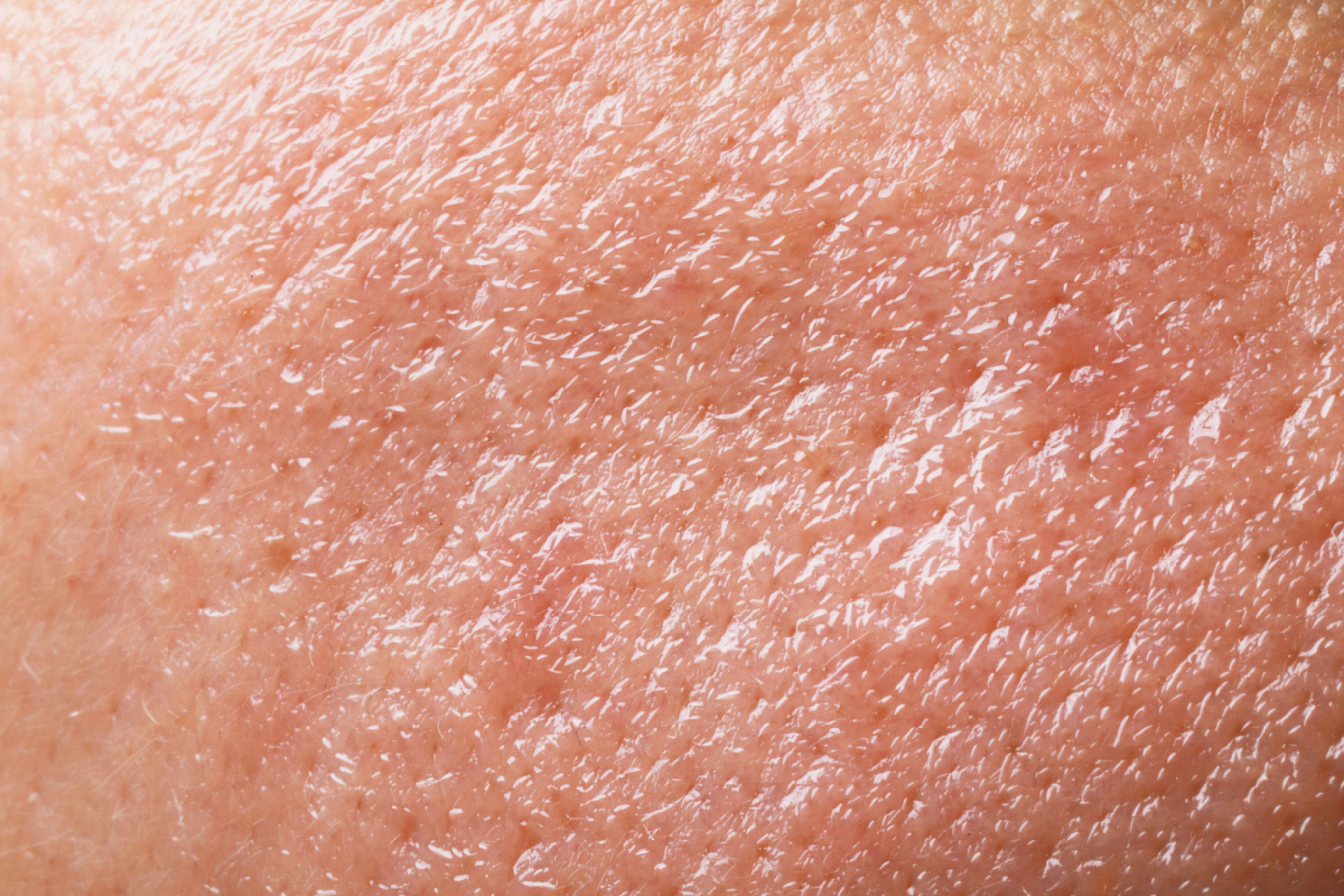 7 Best Facials for Oily Skin