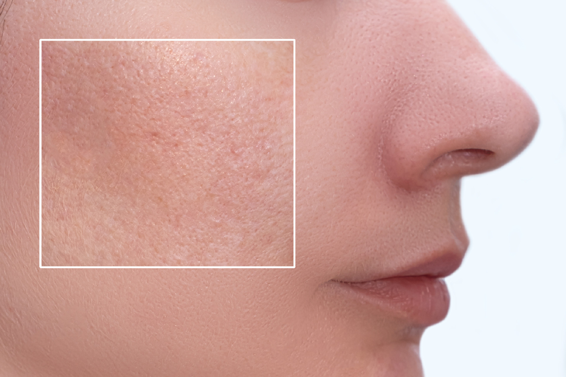 What a Customized Facial Treatment Plan Does
