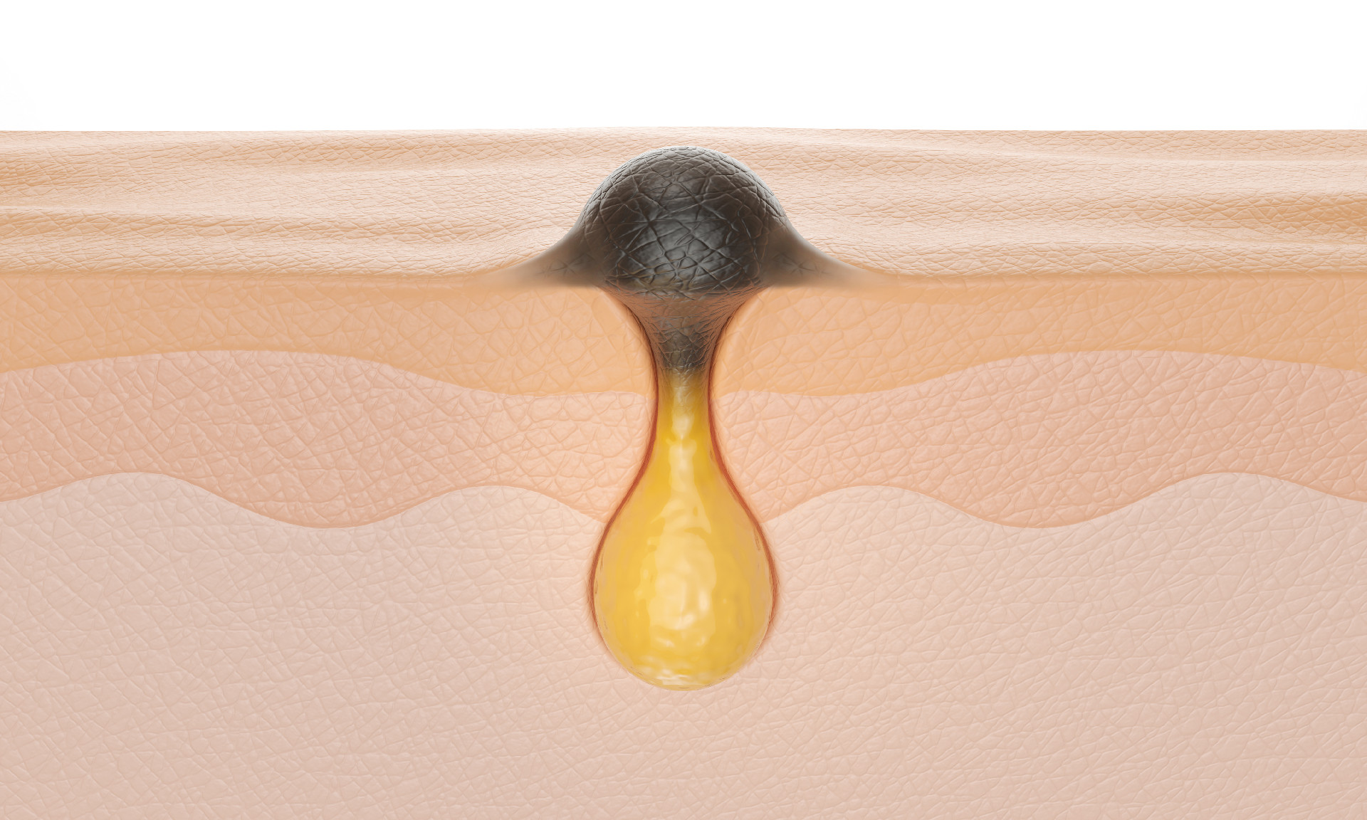 Best Treatments for Clogged Pores